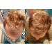 DIY AHK Copper Peptide Solution for Scalp Hair - AHK-Cu Formula - Buy Online on GoSupps.com
