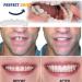 KMOCEPLY 2 Set Instant Veneers - Silicone Fake Teeth & Temporary Denture Mouthpath Guard - Comfortable Snap-On Smile Whitening - Buy Online on GoSupps.com