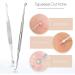 Blackhead Pimple Comedone Spot Acne Extractor/Remover Kit Popper Tools - Buy Online on GoSupps.com