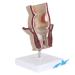 Rectum Model Human Pathological Diseases Rectum Ulcus Acne Pathological Model Use for Model Hemorrhoid Model Demonstration of Anorectal Diseases
