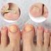 Nail Correction Stickers for Ingrown Toenails Relieve Pain Nail Treatment (50 count) - Buy Online on GoSupps.com