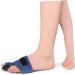 Curled Toe Brace Toe Strap Splint Sponge Composite Cloth Aluminum Alloy Aluminum Plate Blue Buddy Toe Wrap - Buy Online on GoSupps.com