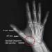 Comfort Cool Thumb CMC Restriction Splint - Right Small Plus 6.5-7.25 - Buy Online on GoSupps.com