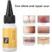 Delicate Skin Scar Treatment Serum - Acne Scar Removal & Repair Cream - 20ml - Buy Online on GoSupps.com