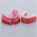 Fhuili Teeth Model for Education | Dental Implant Repair & Communication | Red Dentition Simulation Tool - Buy Online on GoSupps.com