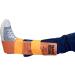 Rescue Essentials SAM SPLINT 3X Combo Pack - 36, 18, and 9 - Orange/Blue - Buy Online on GoSupps.com