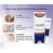 MediScar Silicone Scar Gel 15g - Keloid & Hypertrophic Scar Treatment for Face & Body, Stretch Marks & Surgical Scars - Acne & C-Section Scar Removal - Buy Online on GoSupps.com
