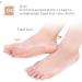 DEAVER Toe Straightener and Bunion Corrector - 2 Pairs of Gel Separators for Overlapping Toes and Big Foot Bone Alignment - Buy Online on GoSupps.com