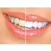 Smilebriter Teeth Whitening Gel Pens - Get a Bright White Smile - Buy Online on GoSupps.com