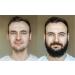 Men's Strong Beard Growth Kit - Beard Balm, Oil, Serum & Derma Roller Set for Natural Beard & Mustache Grooming - Promotes Healthy Beard Growth - Buy Online on GoSupps.com