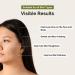 Mandelic Acid 3% + Tartaric Acid 2% - Exfoliating AHA for Brighter Skin | Buy Online Now - Buy Online on GoSupps.com