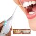 Portable Flosser Dental Water Jet No Batteries or Cords Air Powered Dental Water Jet for Tooth Crevice Between Teeth Dental Periphery
