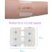 Vrilmed Zip Sutures Wound Closure Device - Non-Woven Fabric Butterfly Bandages for First Aid Laceration Repair - Scar-Free Wound Care - Spec 03 - Buy Online on GoSupps.com