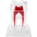 Discriminable Toothed Tooth Model for Endodontics | Plastic Teeth Teaching Material for Dental Studies & Research | International Shipping Available - Buy Online on GoSupps.com