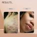 Pure Kojic Acid Soap Brighten Skin Fade Dark Spots & Even Skin Tone International Shipping Available - Buy Online on GoSupps.com
