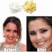 Fake Temporary Tooth Repair Kit - Fix Missing Broken Teeth & Gaps | Natural Yellow Artificial Teeth for a Confident Smile | Includes Magnetic Mirror Box - Buy Online on GoSupps.com