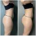 GUAM Anti-cellulite Body Wrap 500g | Professional Seaweed Cellulite Treatment - Buy Online on GoSupps.com