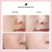 Teekos VEZE Foundation Breathable Lightweight Natural Cosmetic Concealer Pre-Makeup Primer Pore Eraser - Buy Online on GoSupps.com