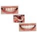 Shop 2 Pairs Cosmetic Dentures - Instant Veneer Teeth for Comfort Fit | Temporary Teeth Solutions - Buy Online on GoSupps.com