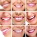 Fluktrix Cosmetic Teeth Veneers - Temporary Comfortable Smile Enhancers for Upper & Lower Teeth - 2 Pairs - Buy Online on GoSupps.com