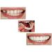 Pastoralist 2 Pairs Dentures Cosmetic Teeth Instant Veneers Temporary Teeth and Bottom Dentures Fit Comfort - Buy Online on GoSupps.com