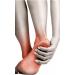 Plantar Fasciitis Compression Sleeve - Small/Medium | International Shipping Available - Buy Online on GoSupps.com