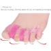 DEAVER Small Gel Toe Separators - Hallux Valgus Corrector & Toe Spacers - 3 Pairs - Buy Online on GoSupps.com