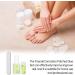 Ingrown Toenail Patch Correction Kit Elastic Toe Nail Straightener Patch with Nail File Glue Ingrown Toenail Pedicure Tool Kit - Buy Online on GoSupps.com