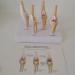 Dog Knee Joint Model Four Stage Knee Arthritis Health Knee and Dog Lesion Joint Model for Veterinary Office Teaching Aids - Buy Online on GoSupps.com