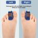 Buy LTL CLZ Toe Rail - Smooth Iron Hammer Toe & Claw Toe Stabilizer Brace - Flesh Color Left - International Shipping - Buy Online on GoSupps.com