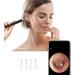 Wireless 1080P FHD Ear Wax Removal Endoscope & Otoscope for iPhone, iPad & Android - Earwax Remover Tool with 6 LED Lights - Black - Buy Online on GoSupps.com