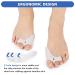 Gel Toe Separators Non-Slip | Bunion Corrector for Foot Pain Relief | Silicone Toe Spacers for Men & Women | Hammer Toe Straightener | Wear in Shoes - Buy Online on GoSupps.com