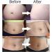 Pregnancy Stretch Mark Cream 120g/4oz - Anti-Stretch Mark Lotion for Mama Tummy - Maternity Skin Care Solution - Buy Online on GoSupps.com
