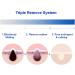 One-day's You P.Z. Ssoc Ssoc No More Blackhead 100ml - Buy Online on GoSupps.com