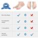DOACT Bunion Corrector with Silicone Gel for Hallux Valgus Pain Relief - Orthopedic Toe Separator for Men and Women - Posture Corrector for Day and Night (Medium) - Buy Online on GoSupps.com