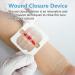 Smerphox Wound Closure Strip - Sterile First Aid Band Kit for Emergency Wound Care - Suture-Free Adhesive Stitch Device - 6pcs - Buy Online on GoSupps.com