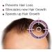 Nutrigrow Anti Hair Loss Conditioner for Faster Hair Growth - Buy Online on GoSupps.com