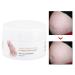 Stretch Stripes Cream 120g | Remove Stretch Marks Pregnancy Scars & Acne | Maternity Repair Treatment - Buy Online on GoSupps.com