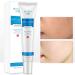 Mark Removal Pro Pimple Ointment - Organic Face Moisturizer for Blemish, Scar, and Spot Removal (White, One Size) - Buy Online on GoSupps.com