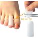 Mofun Digital Toe Caps x2 | Gel Toe Protection | Conditions & Softens | Protects Against Pressure & Friction (Small/Medium) Small/ Medium - Buy Online on GoSupps.com