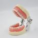 Buy WUURAA 32 Typodont - Removable Demonstration Teeth for Dental Education | International Shipping Available - Buy Online on GoSupps.com