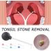 Right-Angled Long Pipe Glass Cleaning Tool - PVC Suction Ball Manual for Teeth Clamp Cleaner - Tonsillenstein Goods - Buy Online on GoSupps.com