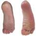Callus and Corn Serum - 1 Count Pack of 1 - White - One Size - Fast Relief for Corns and Calluses - Buy Online on GoSupps.com