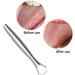 BBASILIYSD U Shape Stainless Steel Tongue Scraper - Improve Oral Hygiene & Freshen Breath | Best Tongue Cleaner Tool - Buy Online on GoSupps.com