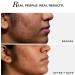 Novology Acne Clearing Serum 0.1% Terpinol Reduce Acne from Day 7 Co-Created with Dermatologists - Buy Online on GoSupps.com