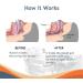 Anti Snoring Devices Effective Snoring Solution Adjustable and Reusable Stop Snoring Devices for Men and Women - Buy Online on GoSupps.com