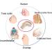 Bunion Relief Corrector Pad - Orthopedic Protector for Hallux Valgus Foot Pain - Toe Separators for Big Joint Tailors - Forefoot Cushion for Ball of Foot - Size Large - Buy Online on GoSupps.com
