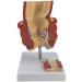 YOtat Human Pathological Hemorrhoids Model-Colorectal Hemorrhoid Lesion Model-Placed On The Base-is The Best Teaching Aid for Doctor-Patient Communication - Buy Online on GoSupps.com
