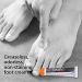Lotrimin AF Cream 1% Clotrimazole Antifungal Treatment 0.42 oz - Athlete's Foot, Jock Itch, Ringworm - Clinically Proven Effective - Buy Online on GoSupps.com