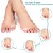 Toe Separator Gel Corrector for Toe Alignment & Bunion Relief - Foot Splint for Overlapping Toes, Hallux Valgus, and Bunions - Ideal for Yogis, Dancers, and Runners - Buy Online on GoSupps.com